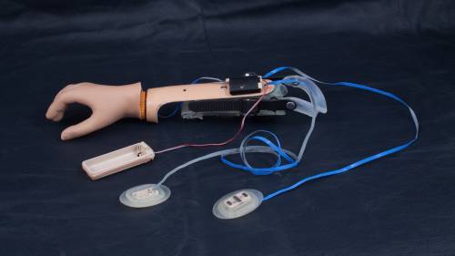 https://www.rijndam.nl/assets/uploads/images/behandelingen/Xperience_Prothese_-_Rijndam_Orthopedietechniek_2.jpg
